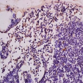 CGMP Rabbit Polyclonal Antibody