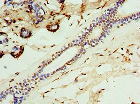 CALCB Antibody