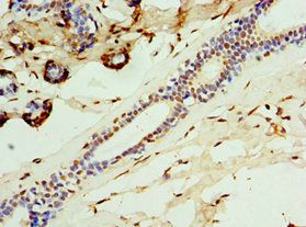 CGRP antibody