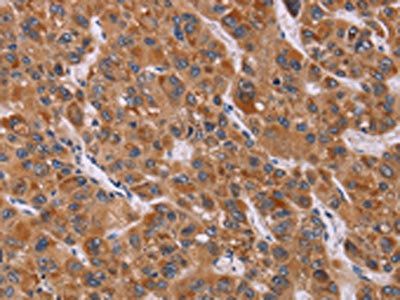 CALCA Antibody