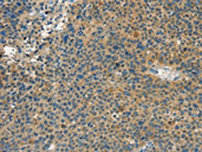 CALCA Antibody