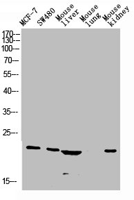 CALCA Antibody