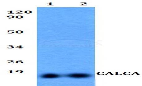 CALCA polyclonal antibody