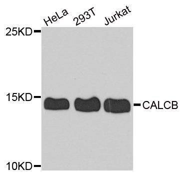 CALCB polyclonal antibody