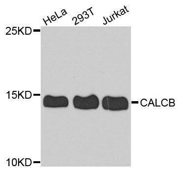 CGRP antibody