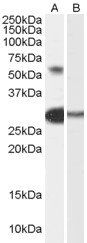 CHA/TCFL5 Antibody