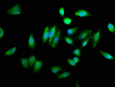 CHAC1 Antibody