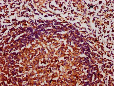 CHAF1A Antibody