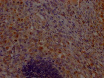 CHCHD5 antibody