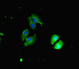 CHD4 Antibody