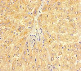 CHD4 Antibody