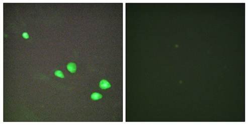 CHD4 Antibody