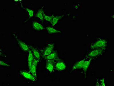 CHD5 antibody