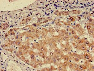 CHD5 Antibody