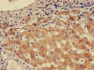 CHD5 antibody