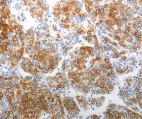 CHD5 antibody