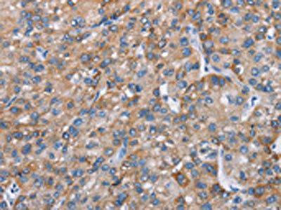 CHDH Antibody