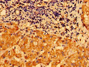 CHDH Antibody