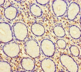 Checkpoint protein HUS1 antibody