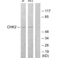 CHEK2 (Ab-68) antibody