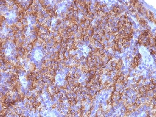 Chromogranin A / CHGA (Neuroendocrine Marker) Antibody