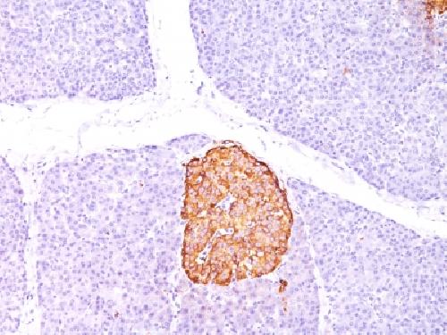 Chromogranin A / CHGA (Neuroendocrine Marker) Antibody