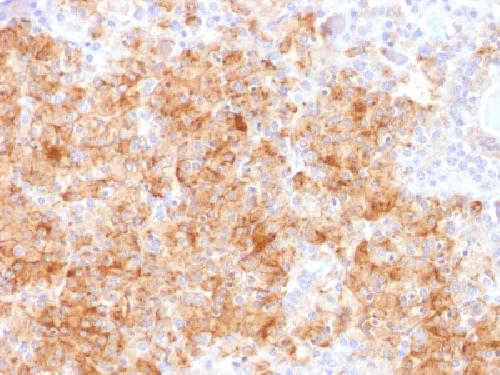 Recombinant Chromogranin A / CHGA (Neuroendocrine Marker) Antibody