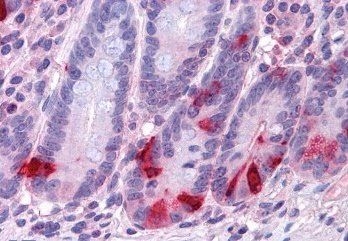 Goat anti-Chromogranin A precursor Antibody
