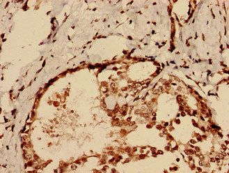 CHID1 Antibody