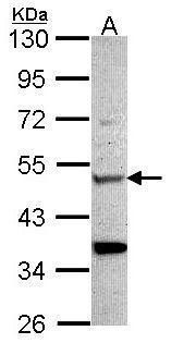ADAR1 antibody [N3C1], Internal