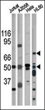 CHK1 (phospho-Ser317) antibody