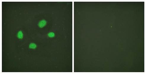 Chk2 (phospho-Thr383) antibody