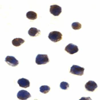 Chk2 Antibody