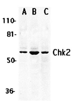 Chk2 Antibody