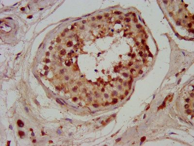 CHMP1A Antibody