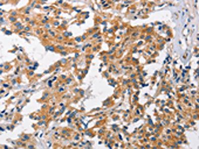 CHMP1A Antibody