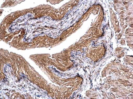 CHMP5 antibody [N1C3]