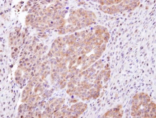 CHMP5 antibody [N1C3]