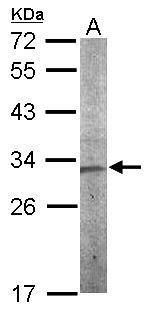 CHMP5 antibody [N1C3]