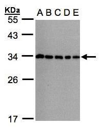 CHMP5 antibody [N1C3]
