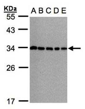 CHMP5 antibody