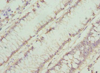 CHN1 antibody