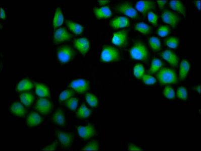 CHODL Antibody