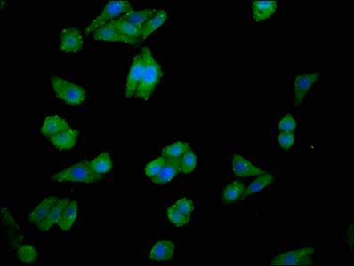 Choline kinase alpha antibody