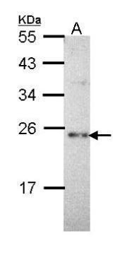 CHP antibody