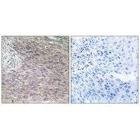 CHPF Antibody