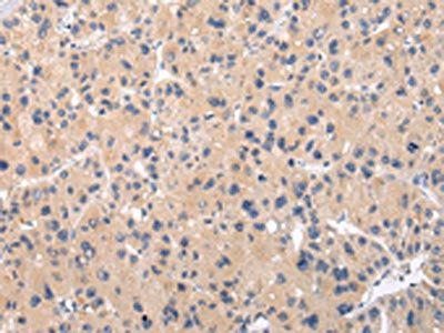 CHRM5 Antibody