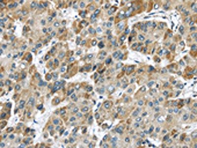 CHRNA1 Antibody