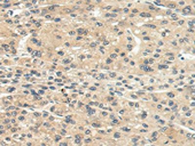 CHRNA1 Antibody
