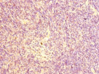 CHRNA10 Antibody